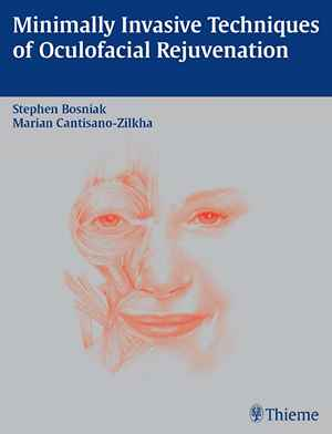 Minimally Invasive Techniques of Oculofacial Rejuvenation  1st
