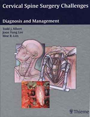 Cervical Spine Surgery Challenges: Diagnosis and Management  1st