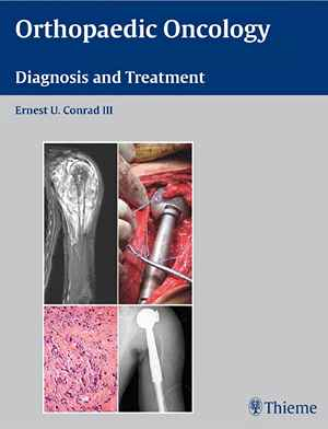 Orthopaedic Oncology: Diagnosis and Treatment  1st