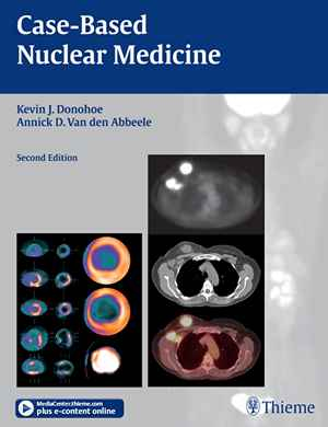 Case-Based Nuclear Medicine 2nd