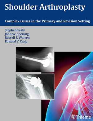Shoulder Arthroplasty: Complex Issues in the Primary and Revision Setting 1st