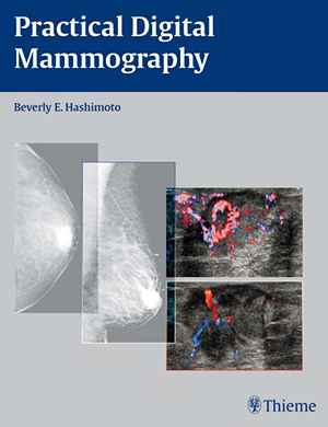 Practical Digital Mammography 1st