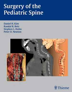 Surgery of the Pediatric Spine  1st