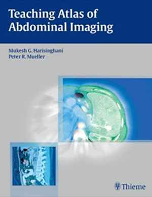 Teaching Atlas of Abdominal Imaging  1st