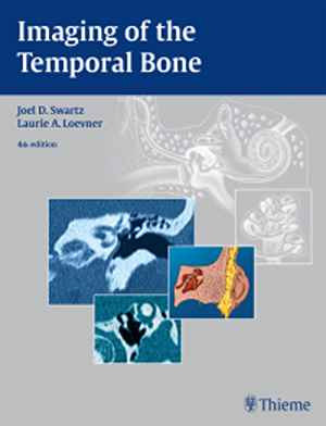 Imaging of the Temporal Bone  4th