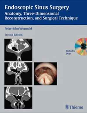 Endoscopic Sinus Surgery: Anatomy, Three-Dimensional Reconstruction, and Surgical Technique  2nd