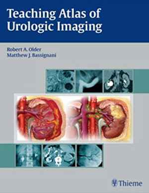 Teaching Atlas of Urologic Imaging 1st