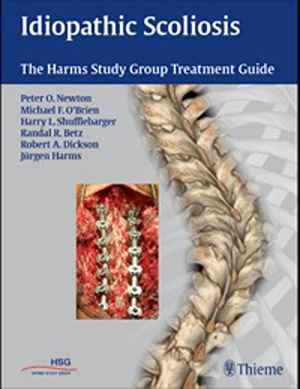 Idiopathic Scoliosis: The Harms Study Group Treatment Guide  1st