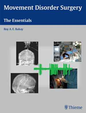 Movement Disorder Surgery: The Essentials 1st