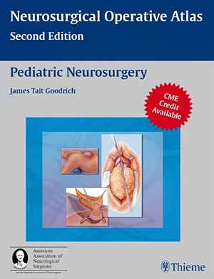 Pediatric Neurosurgery  2nd