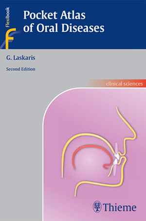 Pocket Atlas of Oral Diseases