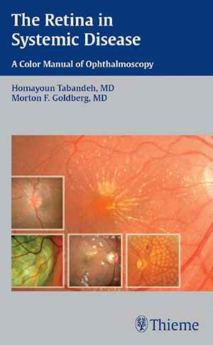 The Retina in Systemic Disease: A Color Manual of Ophthalmoscopy 1st