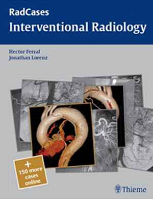 Interventional Radiology  1st