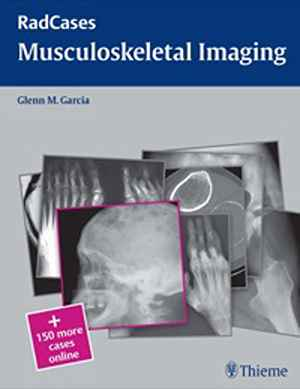 Musculoskeletal Radiology  1st