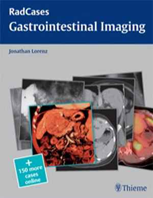 Gastrointestinal Imaging 1st