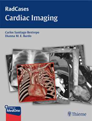 Radcases Cardiac Imaging  1st