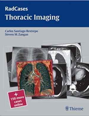 Thoracic Imaging  1st
