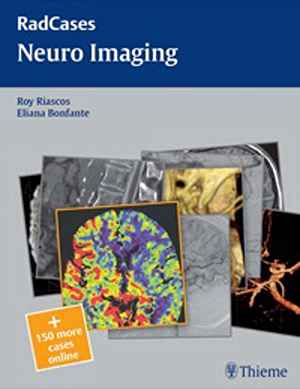 Neuro Imaging 1st