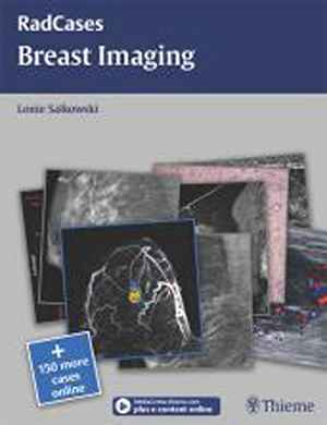 Radcases Breast Imaging  1st