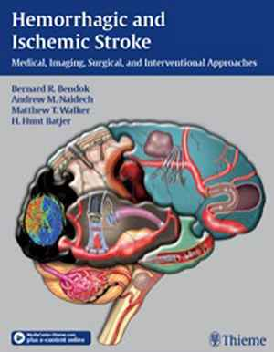 Hemorrhagic and Ischemic Stroke: Medical, Imaging, Surgical and Interventional Approaches  1st