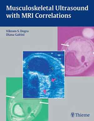 Musculoskeletal Ultrasound with MRI Correlations 1st