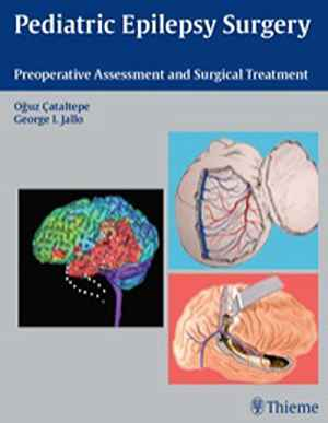 Pediatric Epilepsy Surgery: Preoperative Assessment and Surgical Treatment  1st