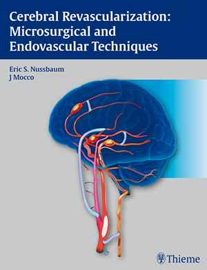 Cerebral Revascularization: Microsurgical and Endovascular Techniques  1st