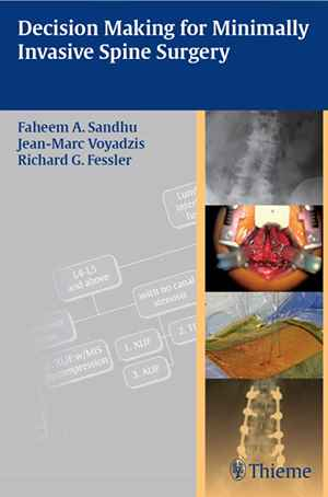 Decision Making for Minimally Invasive Spine Surgery 1st