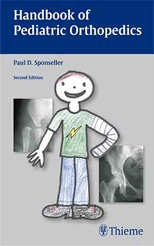 Handbook of Pediatric Orthopedics 2nd