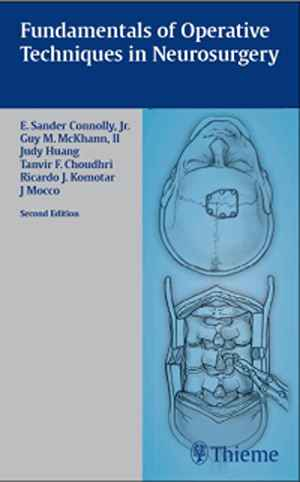 Fundamentals of Operative Techniques in Neurosurgery 2nd