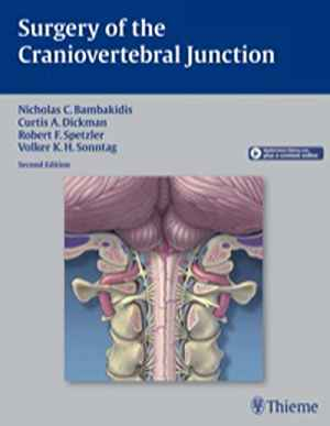 Surgery of the Craniovertebral Junction  2nd