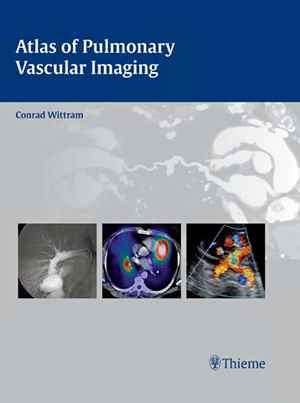 Atlas of Pulmonary Vascular Imaging  1st