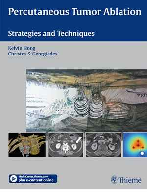 Percutaneous Tumor Ablation: Strategies and Techniques  1st
