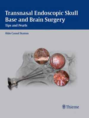 Transnasal Endoscopic Skull Base and Brain Surgery: Tips and Pearls  1st