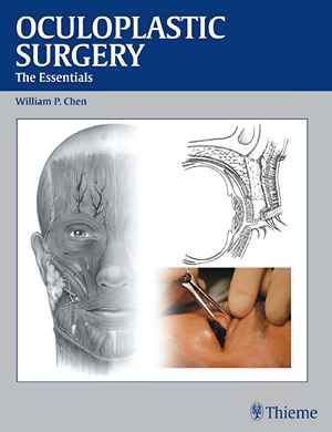 Oculoplastic Surgery: The Essentials 1st