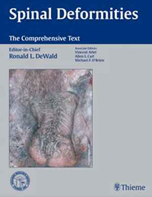 Spinal Deformities: The Comprehensive Text  1st