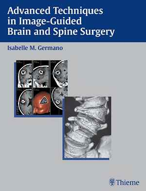 Advanced Techniques in Image-Guided Brain and Spine Surgery  1st