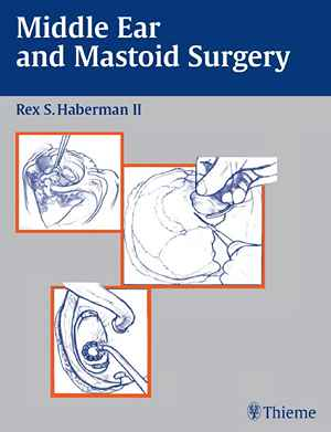 Middle Ear and Mastoid Surgery  1st