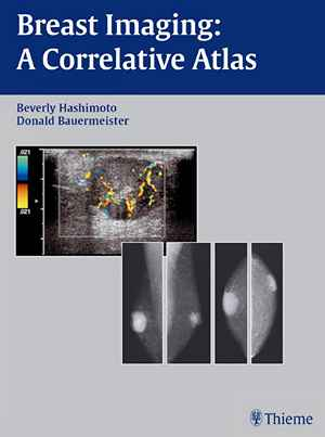 Breast Imaging: A Correlative Atlas  1st