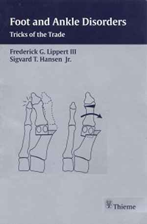 Foot and Ankle Disorders: Tricks of the Trade 1st