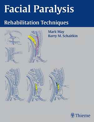 Facial Paralysis: Rehabilitation Techniques 1st