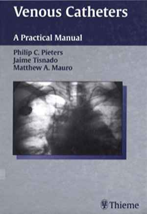 Venous Catheters: A Practical Manual  1st