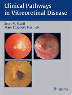 Clinical Pathways In Vitreoretinal Disease 1st