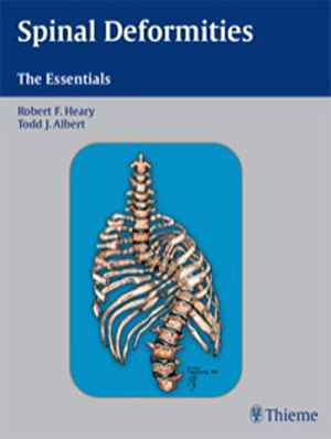 Spinal Deformities: The Essentials 1st