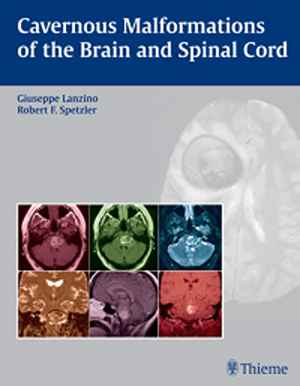 Cavernous Malformations of the Brain and Spinal Cord 1st