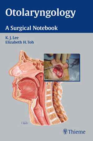 Otolaryngology: A Surgical Notebook 1st