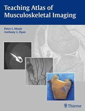 Teaching Atlas of Musculoskeletal Imaging  1st