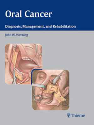 Oral Cancer: Diagnosis, Management, and Rehabilitation  1st