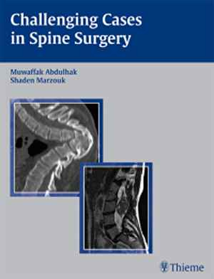 Challenging Cases in Spine Surgery 1st