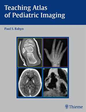 Teaching Atlas of Pediatric Imaging  1st